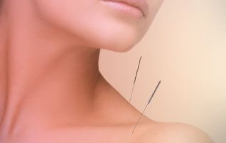 Acupuncture