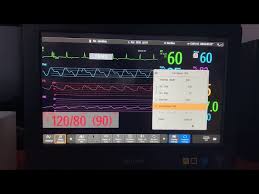 Philips IntelliVue MX800