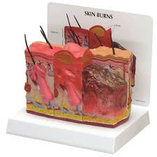 Burn Classification Model