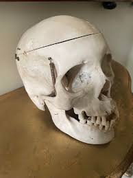 Pathological Skull Model