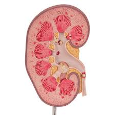 Kidney Stones Model